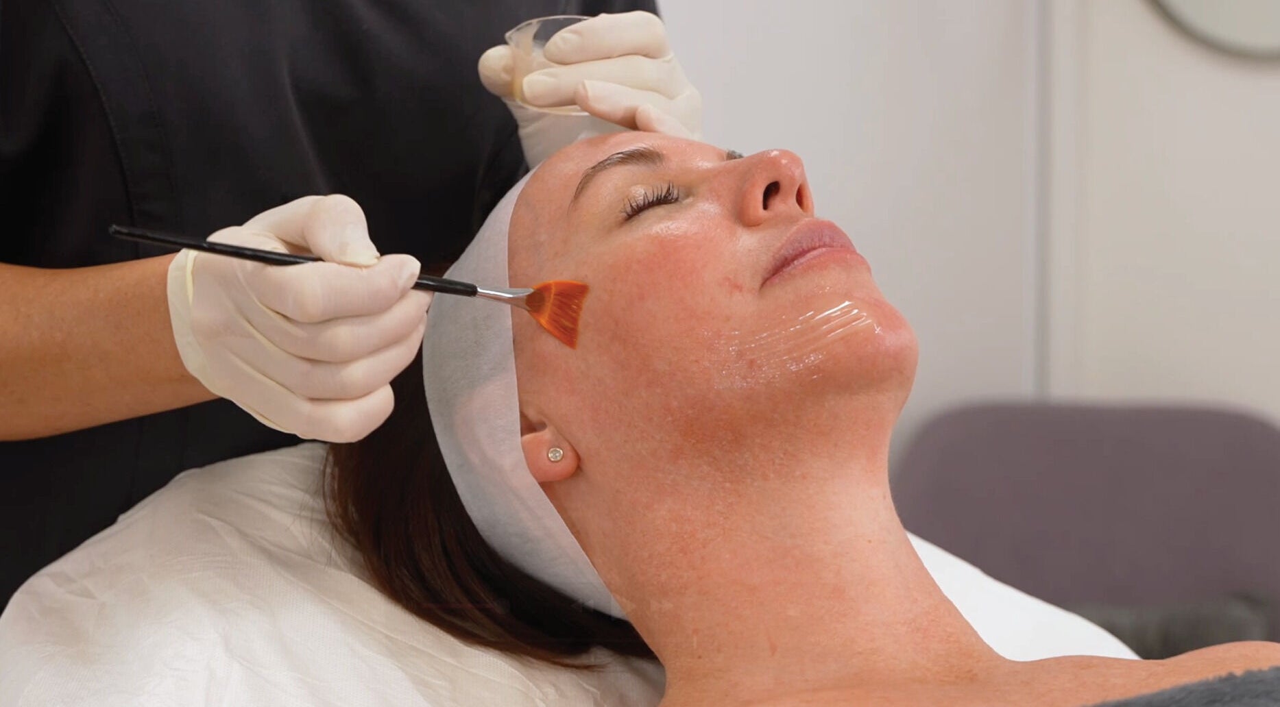 Facial treatment at Life Labs Aesthetics in East Brisbane, Queensland, AU. Skin rejuvenation in progress.