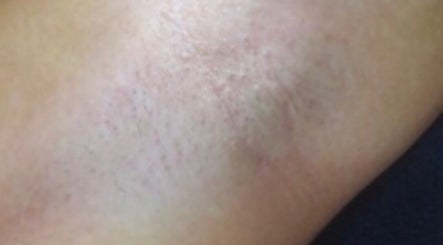 Bare Skin Co., bilde 3