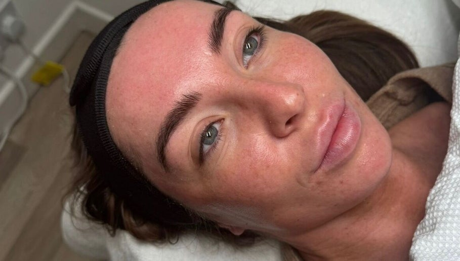 Elluxeskin image 1