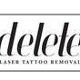 Delete - Laser Tattoo Removal