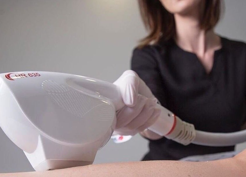 Laser treatment at The Beauty Room in Oshawa, Ontario, CA, showcasing advanced care.