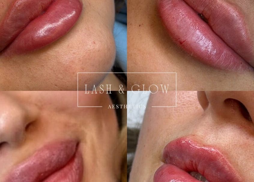 Collage of enhanced lips at Lash & Glow By Jessica in Isleham, England, GB. Perfect lip treatments on display.