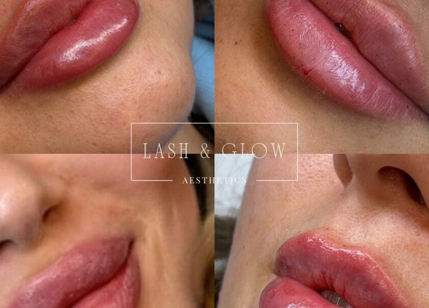 Collage of enhanced lips at Lash & Glow By Jessica in Isleham, England, GB. Perfect lip treatments on display.