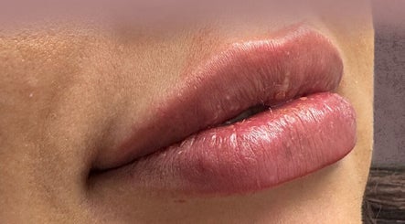 Plum Creek Medical Group - Medical Aestheticsの画像：2