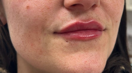 Plum Creek Medical Group - Medical Aestheticsの画像：3