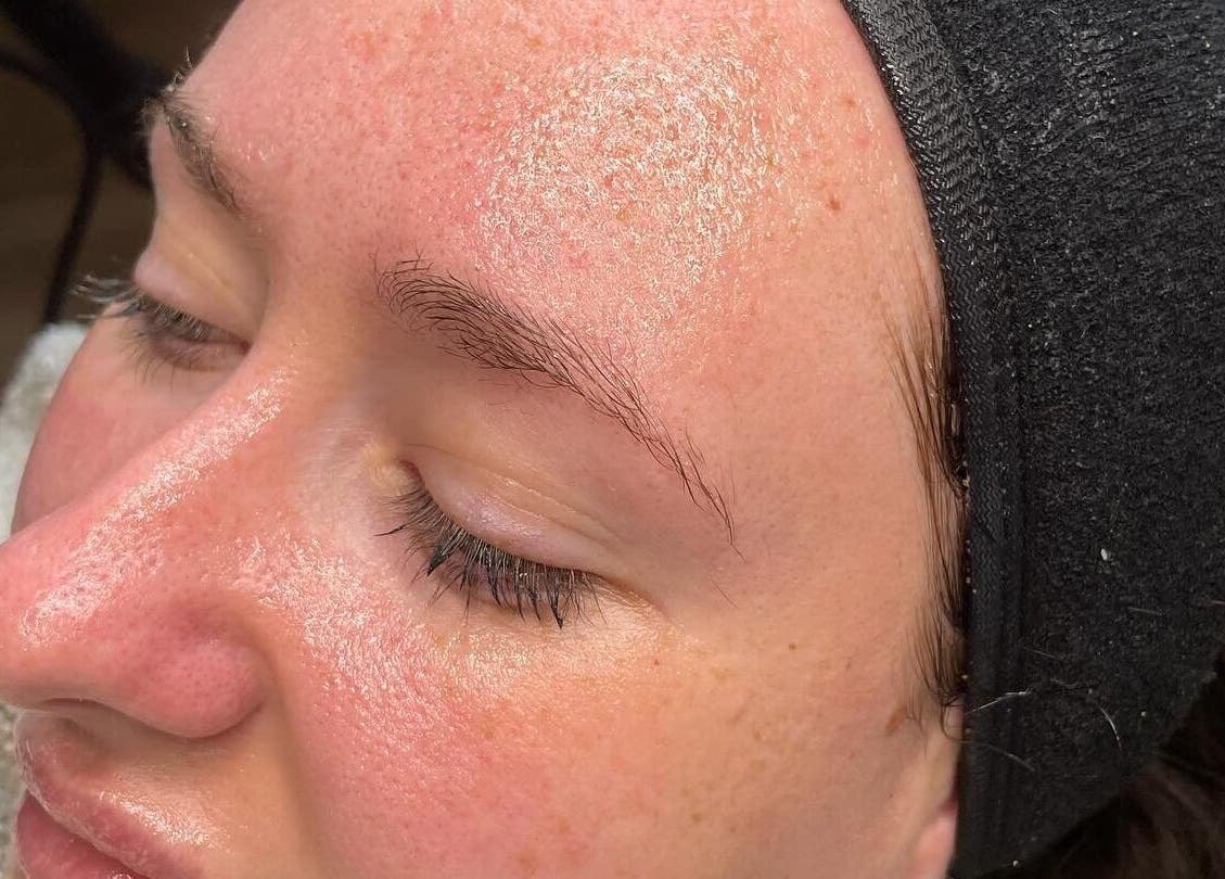 Close-up of a glowing face after a facial treatment at Medi Dermis Aesthetics, Chorley, England, GB.