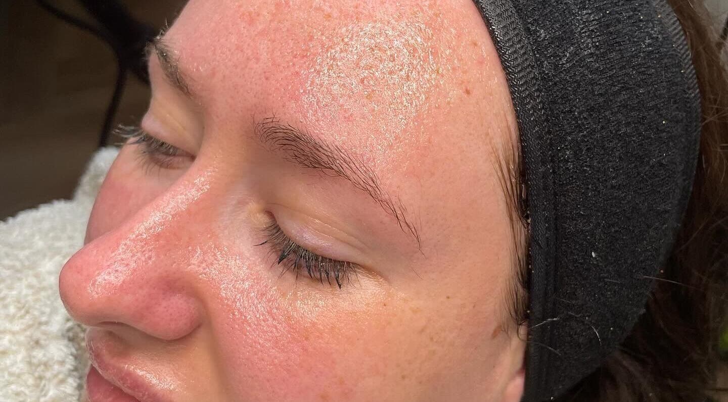 Close-up of a glowing face after a facial treatment at Medi Dermis Aesthetics, Chorley, England, GB.