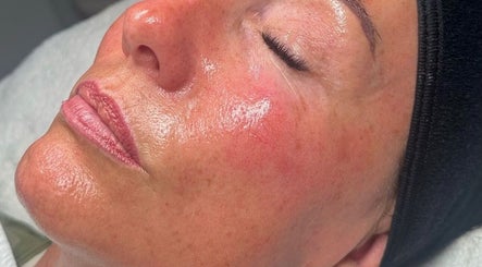 Close-up of a glowing facial treatment at Skinlaville, Hounslow, England, GB, highlighting smooth skin.