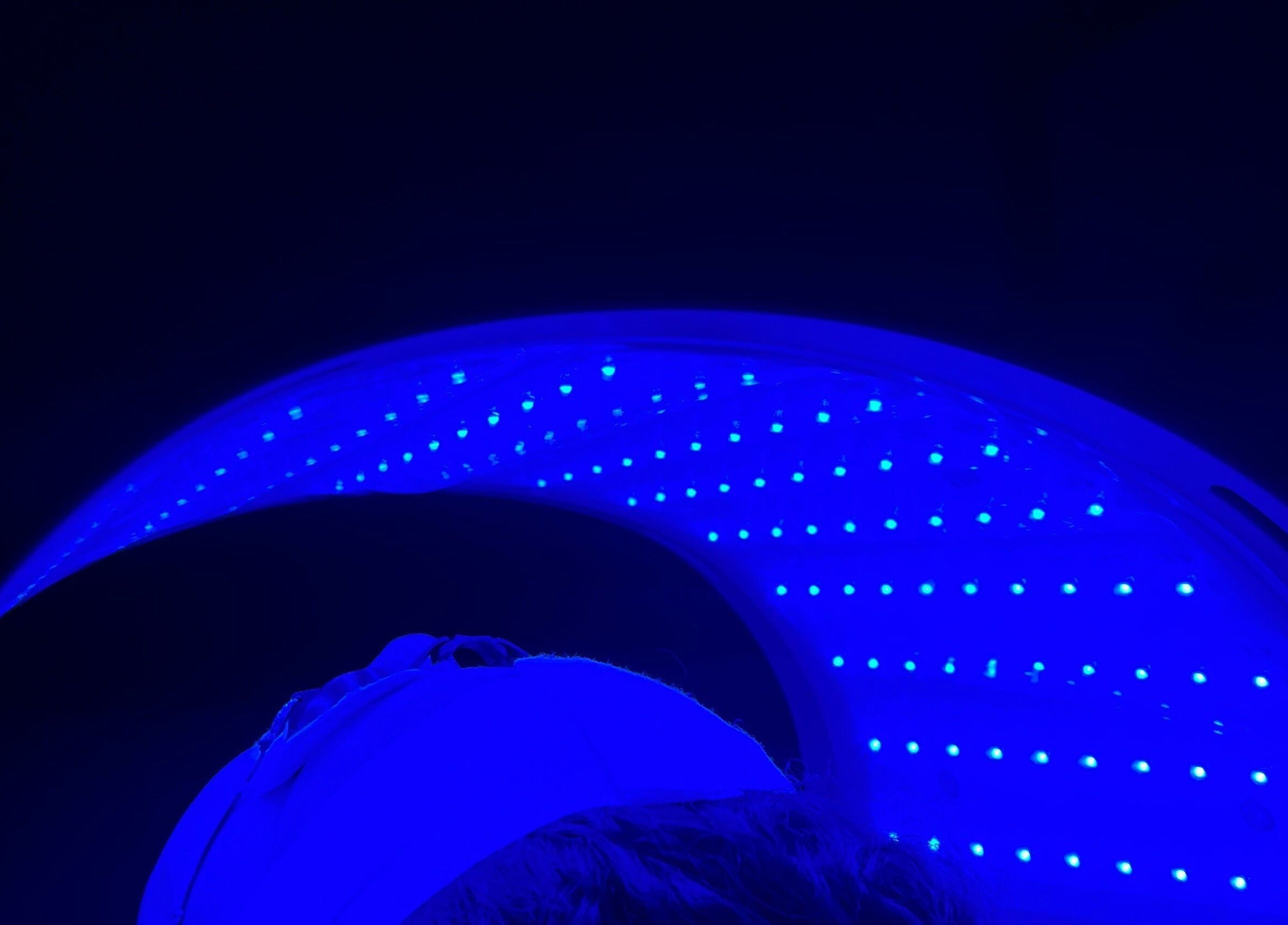 Blue LED light therapy at Illuminate Aesthetics Lounge in Toronto, Ontario, CA.