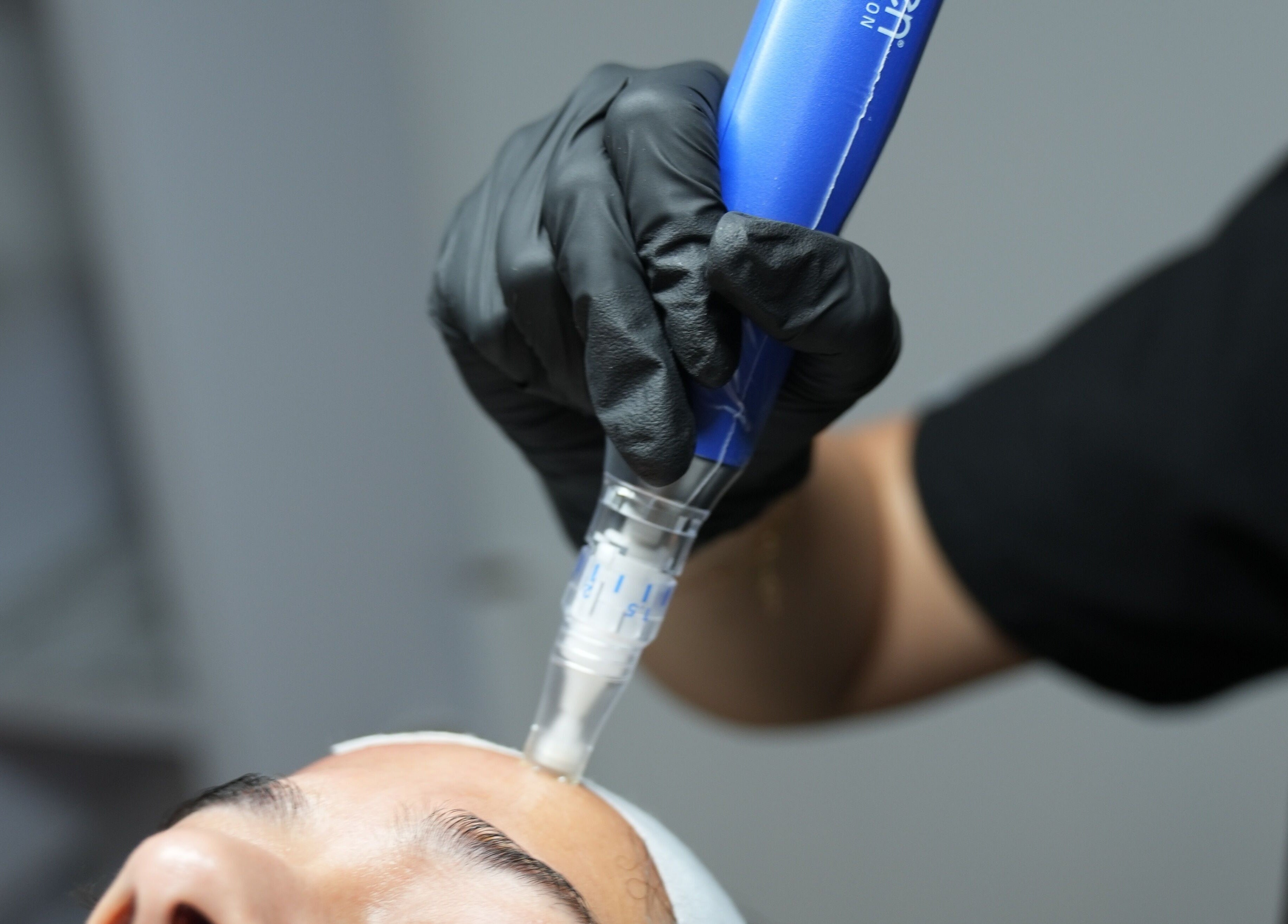 Professional skincare treatment at Illuminate Aesthetics Lounge, Toronto, Ontario, CA, showcasing precise care.