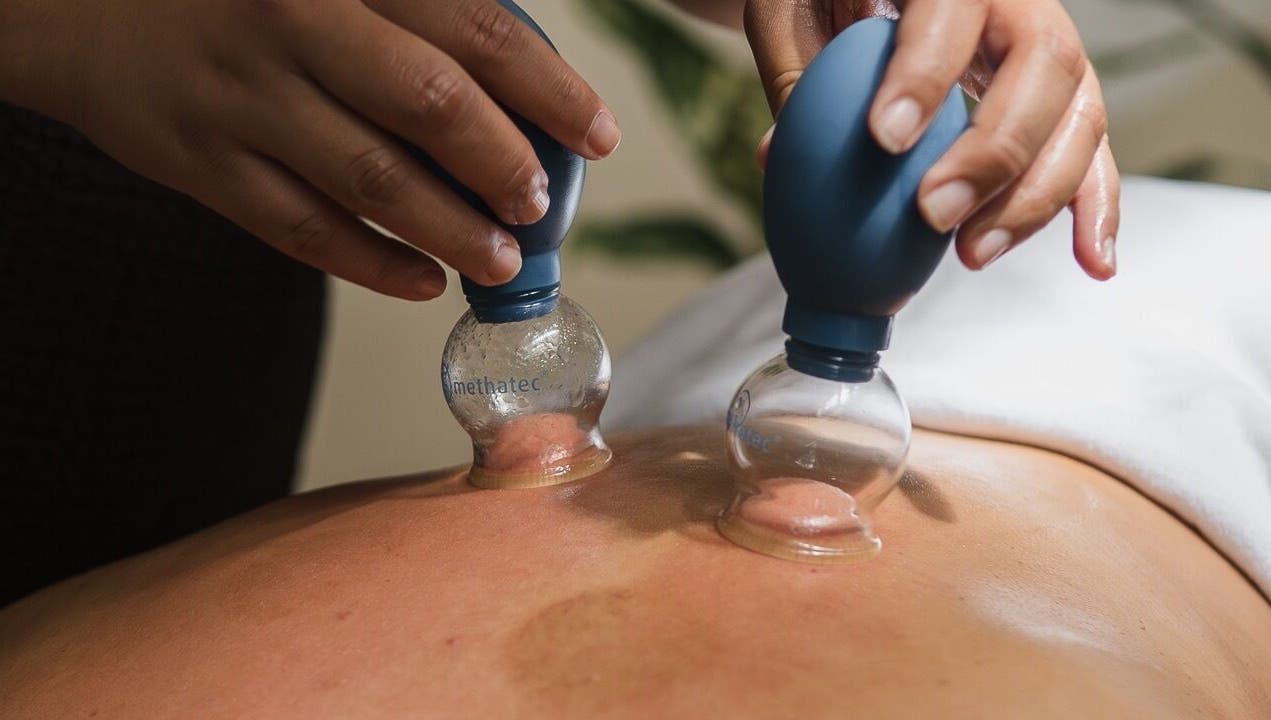 Cupping therapy at Cupping It Out in Oranjestad, AW, showing hands applying suction cups on a back.
