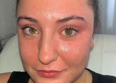 Close-up of a woman's radiant skin after treatment at Dream Aesthetics, Chelmsford, England, GB.