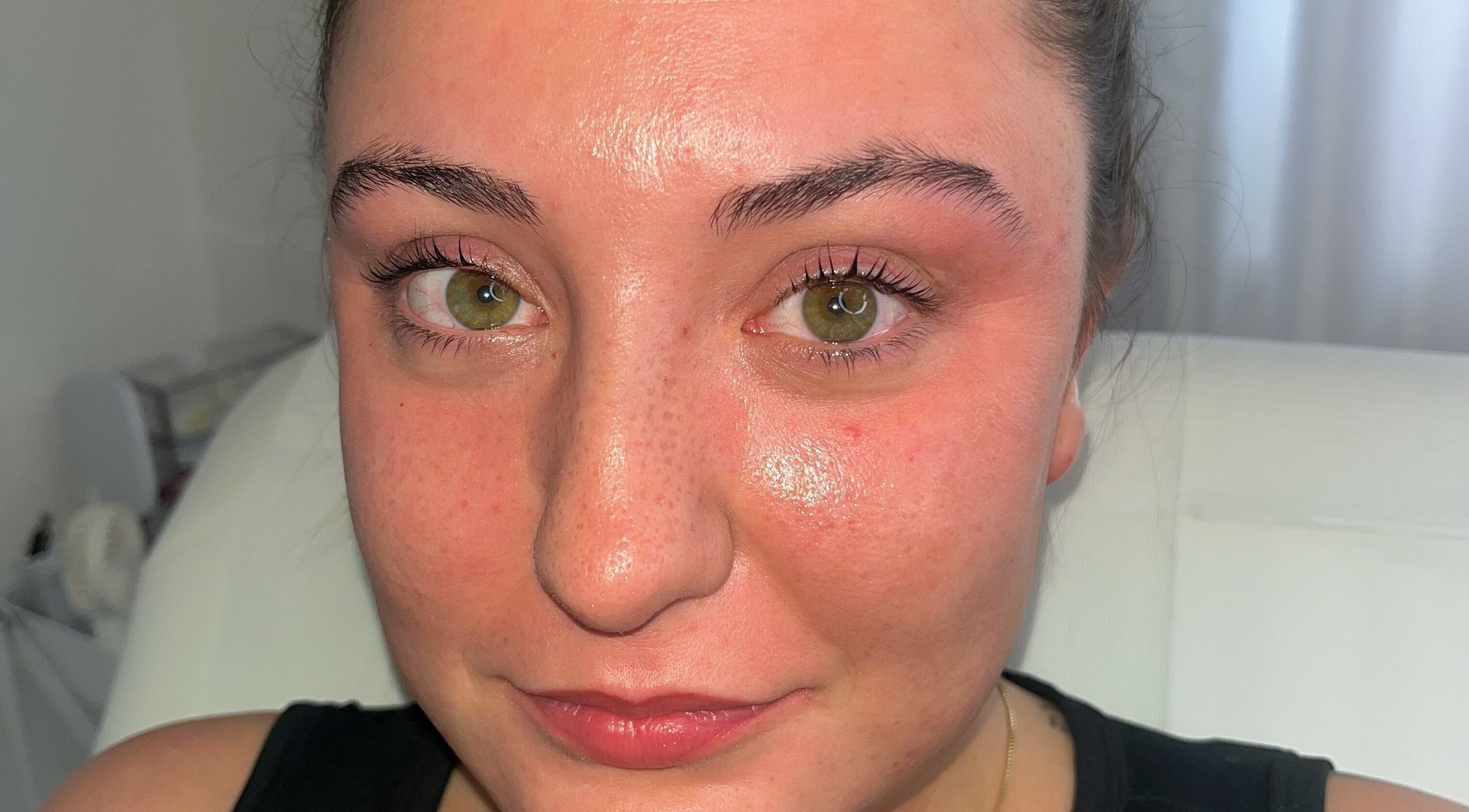 Close-up of refreshed skin after facial treatment at Dream Aesthetics, Chelmsford, England, GB.