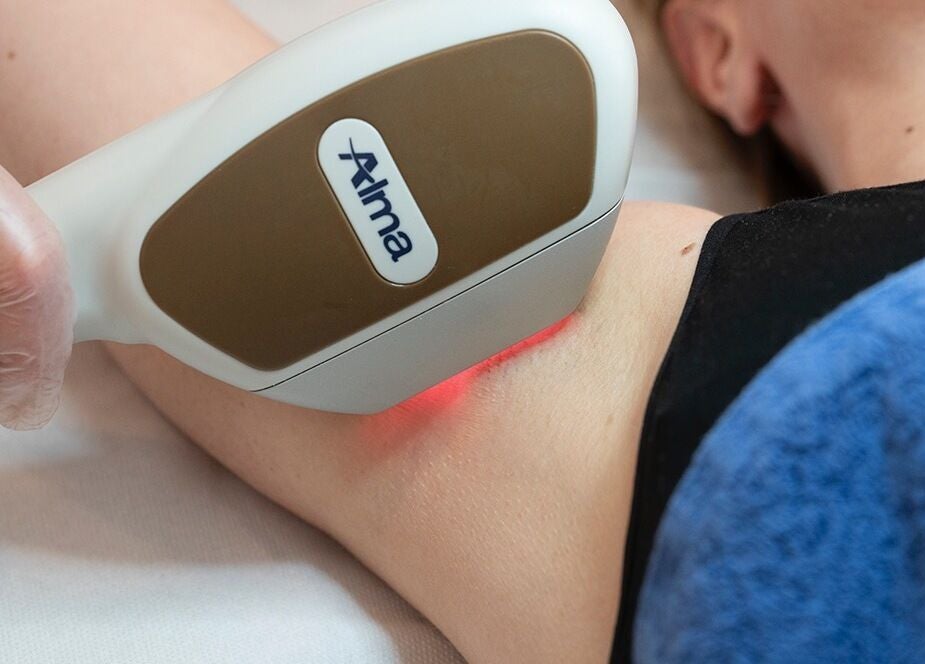 Épilation laser en douceur chez Klaris Esthétique, Paris, Île-de-France, FR.