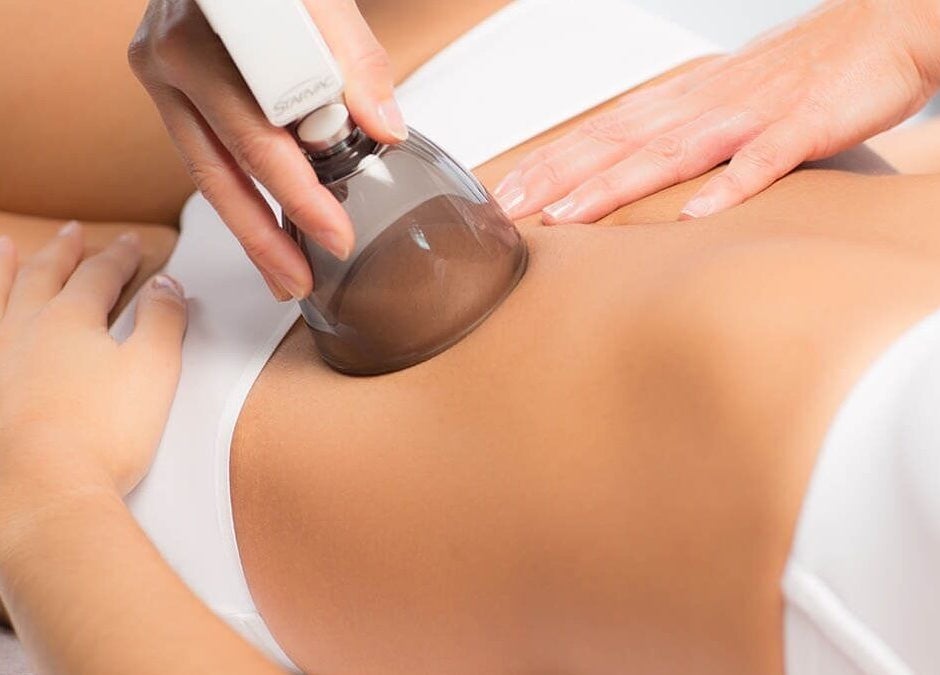 Traitement amincissant au Klaris Esthétique, Paris, Île-de-France, FR, utilisant une ventouse minceur.