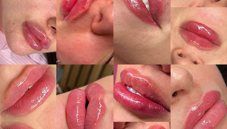 Ms morphe, bild 1