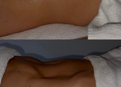 Body massage treatment room at Body Therapy Studio in Melbourne, Victoria, AU, with warm lighting and towels.