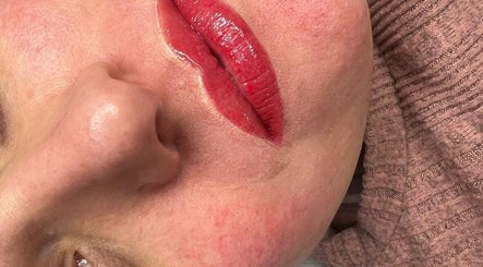 KF Beaty изображение 3