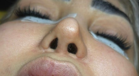 El therapy image 3