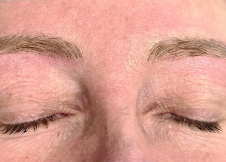 Close-up of eyebrow transformation at AKBrows - Richmond, Richmond, England, GB.