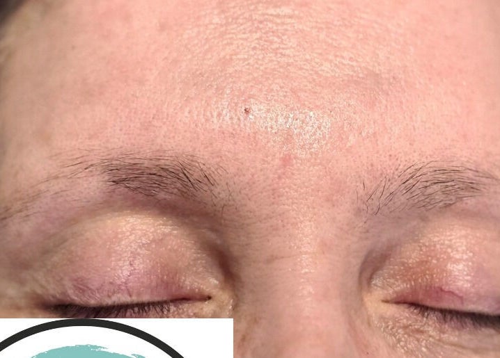 Close-up of eyebrows before treatment at AKBrows Accrington, Accrington, England, GB, showing natural hair growth.