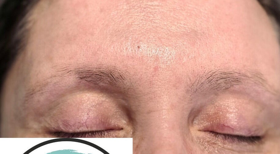 Close-up of eyebrows before treatment at AKBrows Accrington, Accrington, England, GB, showing natural hair growth.