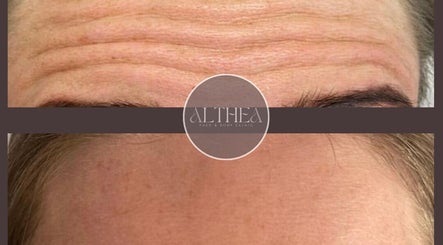 Althea Face & Body Clinic, bilde 2