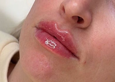 Lips with glossy finish at Dolled By Moll, Chislehurst, England, GB. Expert beauty treatments enhance natural beauty.