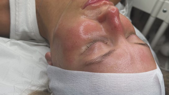 Elite skin clinic london