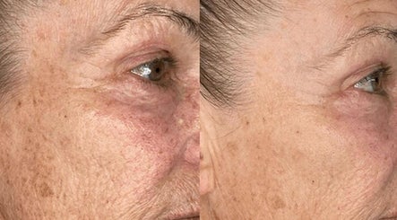 Elite skin clinic london Bild 2