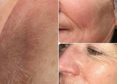 Before and after facial treatment at Pretty Perfect at Dolce Capelli, Glasgow, Scotland, GB showcasing skin glow.