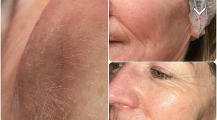 Before and after facial treatment at Pretty Perfect at Dolce Capelli, Glasgow, Scotland, GB showcasing skin glow.