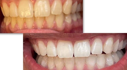 Pearly Smile Studio image 3