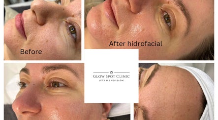 Glow Spot Clinic Bild 3