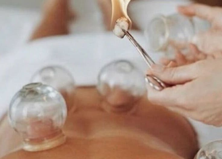 جلسة حجامة في 'Let’s Spa - Home Service' بالرياض، منطقة الرياض، SA. تحسين الصحة والعافية.