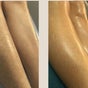 Kss waxing