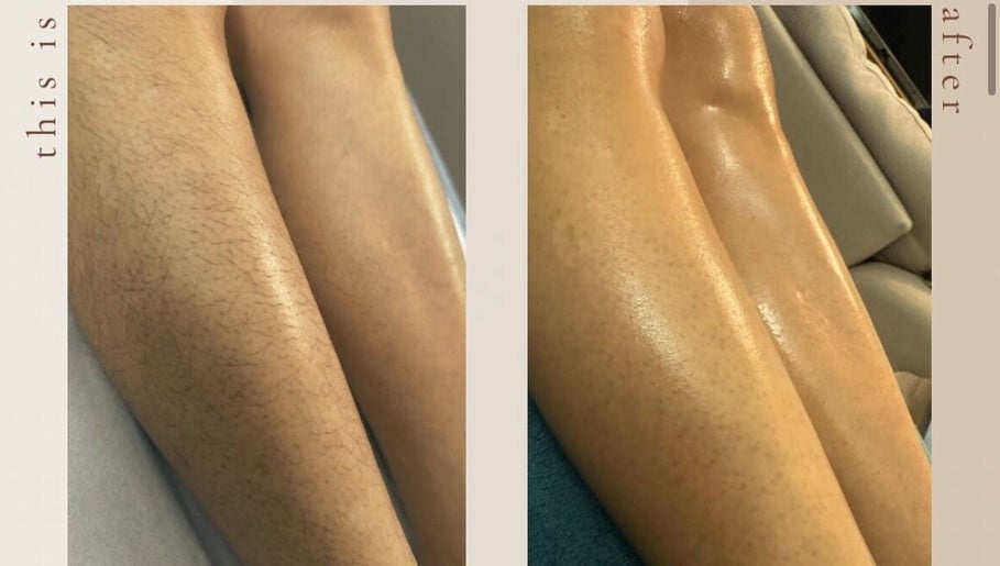 Kss waxing – obraz 1