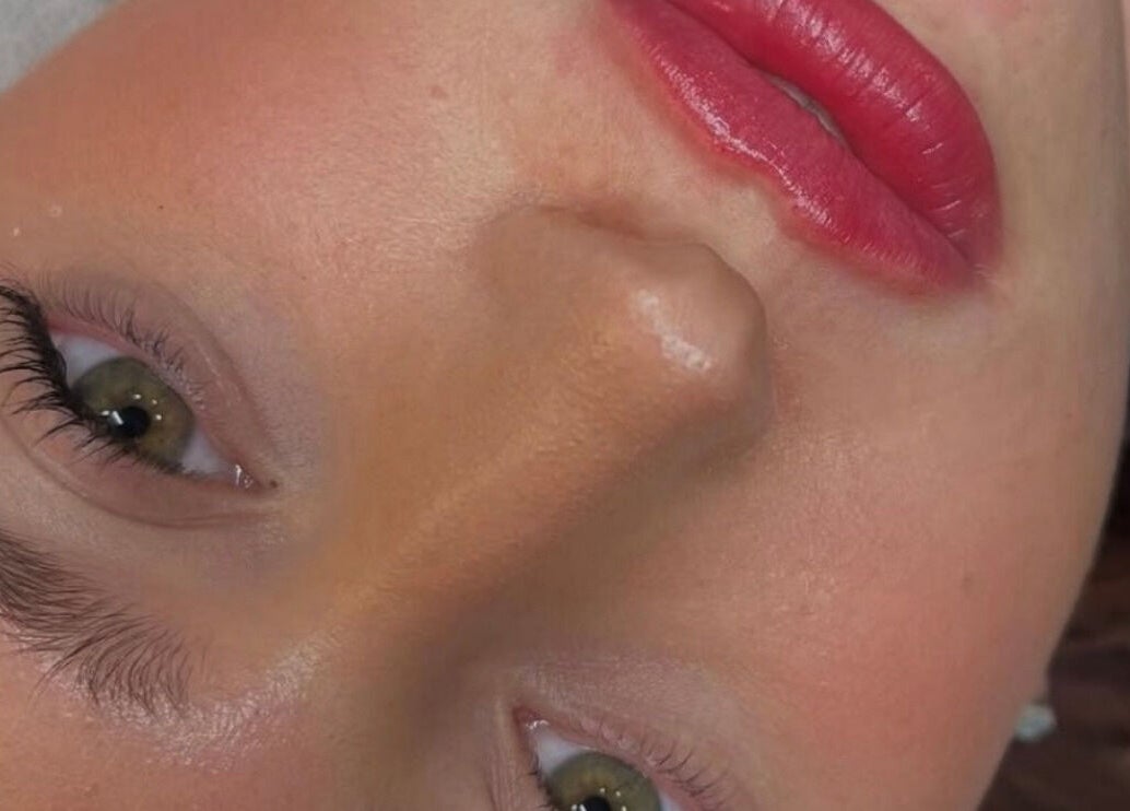 Close-up of a radiant face showcasing skin treatment results at Diamond Aesthetics, Reading, England, GB.