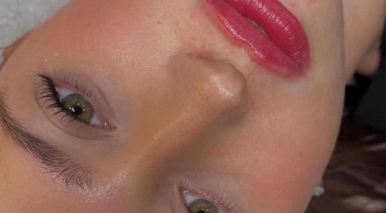 Close-up of a radiant face showcasing skin treatment results at Diamond Aesthetics, Reading, England, GB.