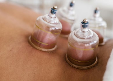 Cupping therapy session at Innerverse Wellness Centre - Southbank, Melbourne, AU enhances relaxation and healing.