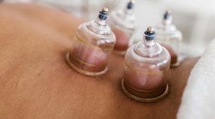 Cupping therapy session at Innerverse Wellness Centre - Southbank, Melbourne, AU highlights holistic healing.