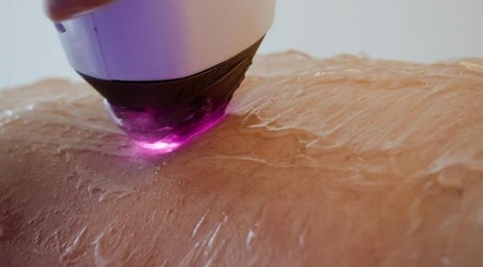 Laser by K