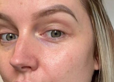 Close-up of smooth skin treatment result at Skinergi, Corby, England, GB.