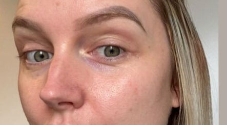 Close-up of smooth skin treatment result at Skinergi, Corby, England, GB.