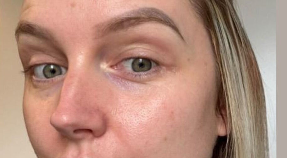 Close-up of smooth skin treatment result at Skinergi, Corby, England, GB.