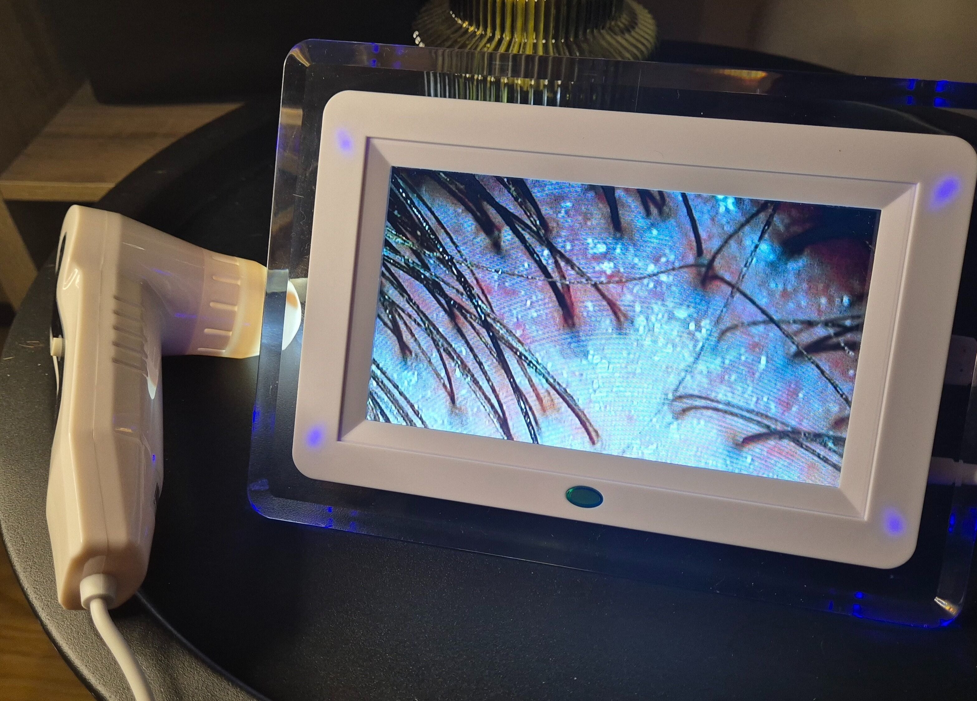 Close-up of hair microscopy at Japanese head spa by Lucy Butterly in Horsham, England, GB.