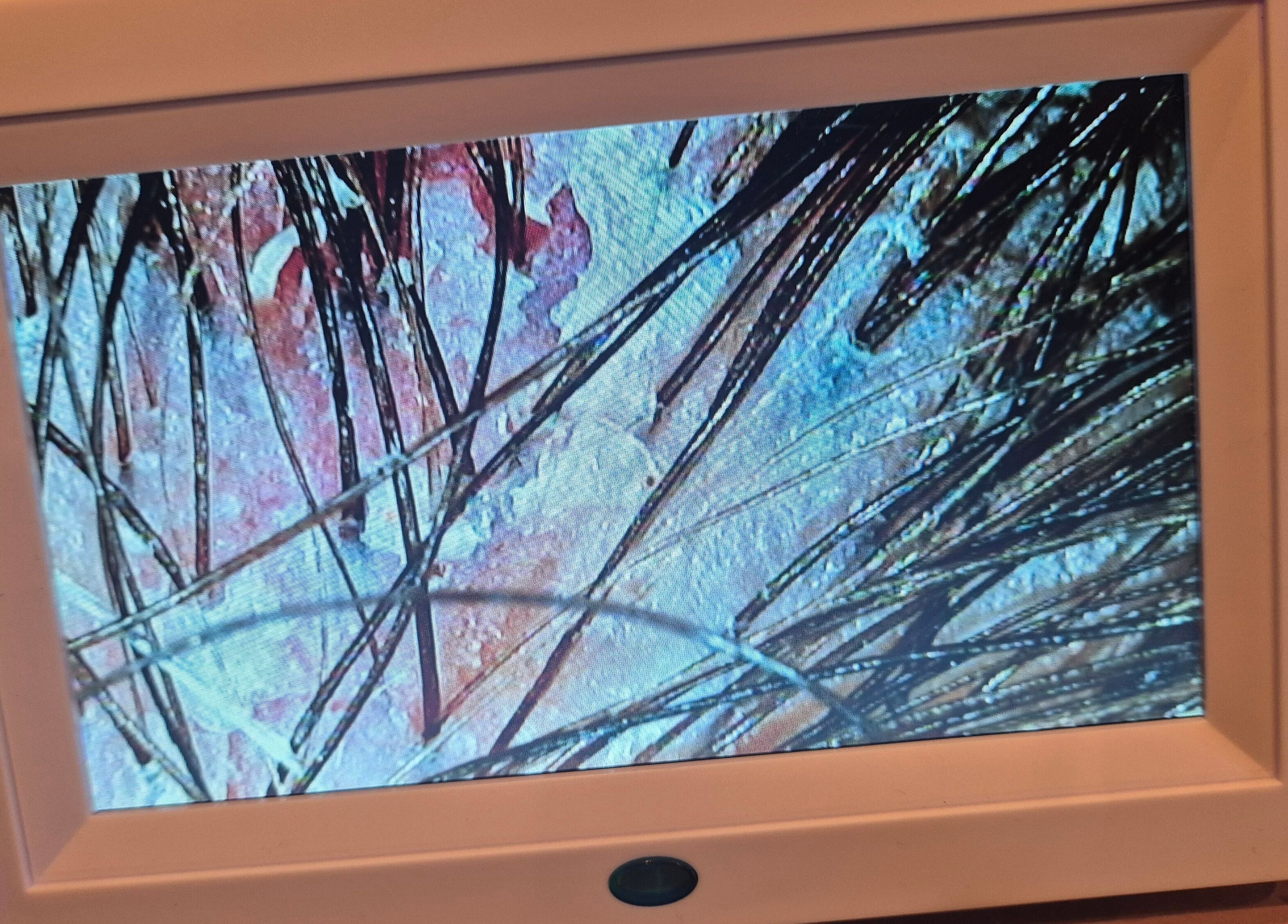 Microscopic view of hair and scalp at Japanese head spa by Lucy Butterly, Horsham, England, GB.