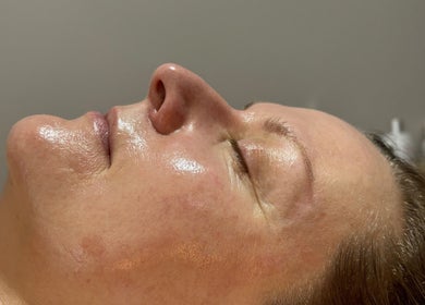 Close-up of a client's glowing skin during a facial at Pure Esthetics in Chester, England, GB.