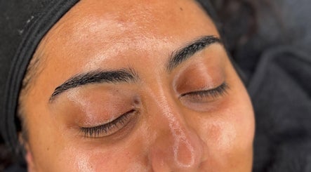 SARAY SKIN imagem 2