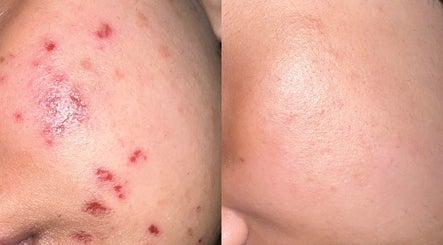 SARAY SKIN imagem 3